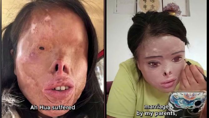 Bị chồng cũ tạt axit mù mắt: Người phụ nữ gây sốc khi tự ‘vẽ’ lại dung nhan để đổi đời