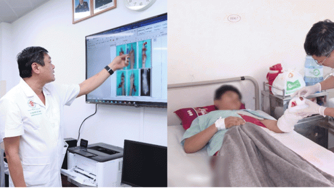 Gia đình hoảng sợ khi con trai 15 tuổi gặp tai nạn khi pháo tự chế phát nổ: Mất vĩnh viễn 2 ngón tay