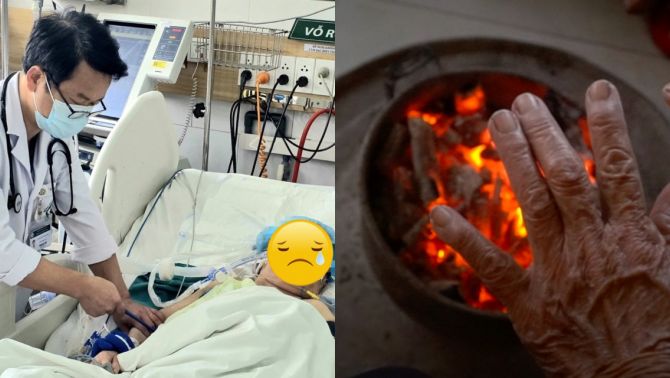 Sưởi ấm giữa đợt rét đậm, thói quen quen thuộc khiến nhiều người nhập viện, có ca không qua khỏi tại Hà Nội