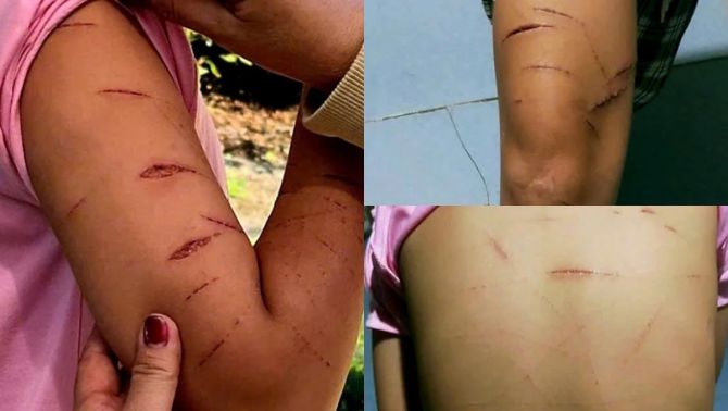 Nguyên nhân khiến bé gái lớp 5 bị rạch 200 nhát trên người ở Cà Mau: Liên quan đến dì ruột nạn nhân