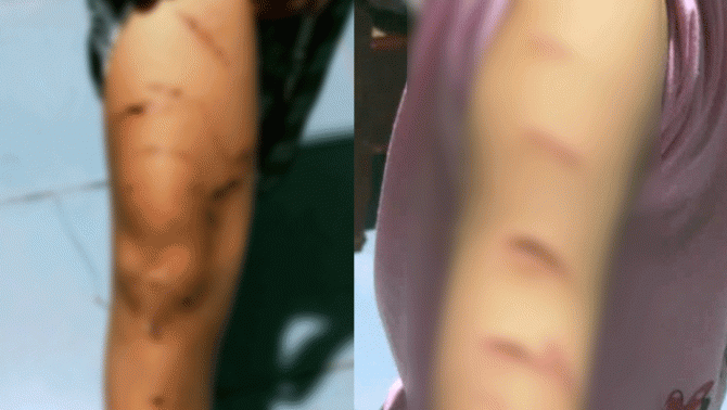 Chủ tịch UBND tỉnh Cà Mau lên tiếng vụ bé gái lớp 5 bị chị họ dùng dao cắt giấy rạch hàng trăm nhát