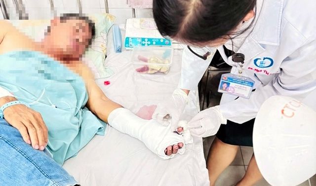 Đồng Nai: Nam thanh niên đứt lìa ngón tay vì nồi bánh chưng Tết