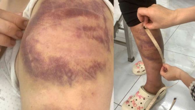 Lời khai của gã đàn ông hành hạ vợ mang thai và con gái 13 tuổi suốt nhiều ngày ở Bắc Ninh