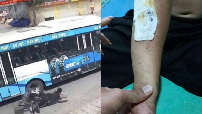 Thông tin mới vụ tài xế xe buýt tông học sinh rồi nói ‘không biết’: Gia đình nạn nhân lên tiếng