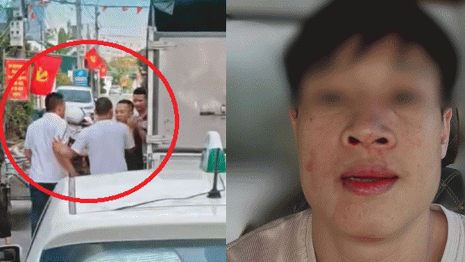 Hải Phòng: 4 gã đàn ông nhổ nước bọt, đánh đập tài xế lái xe tải dù đã được chủ động nhường đường