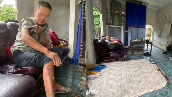 Đã xử phạt nhóm học sinh hành hạ người đàn ông ở Huế, bất ngờ tình hình của nạn nhân hiện tại