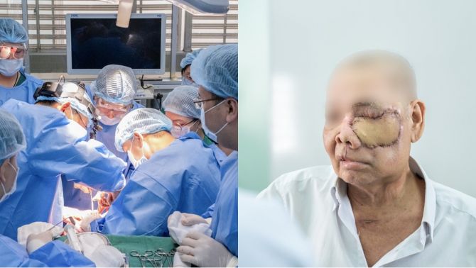 8 khoa vào cuộc làm nên cuộc đại phẫu ’10 tiếng’ chưa từng có ở Bệnh viện Chợ Rẫy, cứu bệnh nhân ung thư hốc mũi