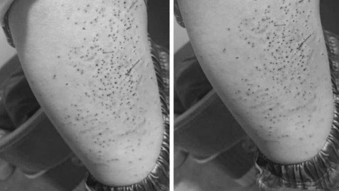 Lào Cai: Bất ngờ lý do khiến nam sinh lớp 7 bị bạn cùng lớp dùng bút bi đâm kín đùi