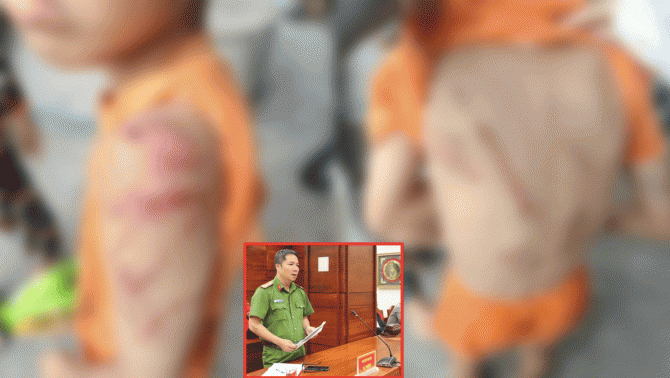 Cha đánh con trai 10 tuổi bầm tím khắp người: Nguyên nhân ra tay và loạt chi tiết bất ngờ về cậu bé