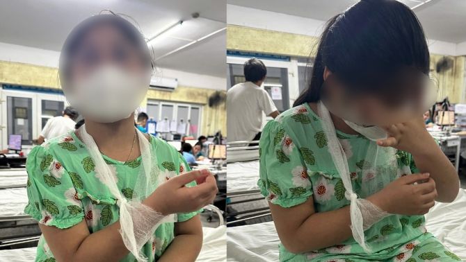 Vụ học sinh lớp 4 bị đánh chấn thương tay: Cô giáo thừa nhận mọi việc, nhà trường nêu hướng xử lý