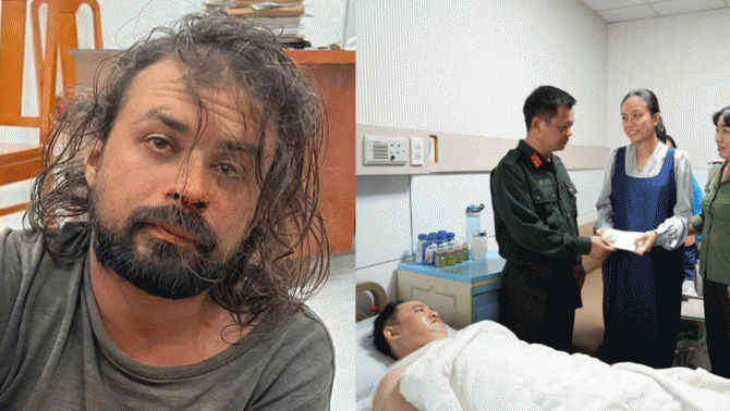 Người đàn ông nước ngoài dùng dao đâm thiếu tá công an: Nghi phạm phải đối mặt với nhiều tội danh?