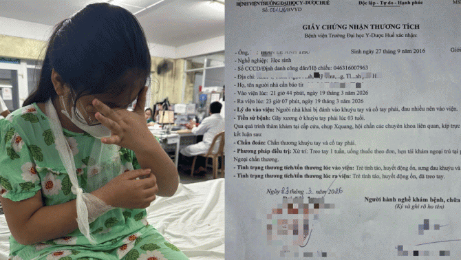 Vụ cô giáo đánh học sinh phải bó bột ở Huế: Diễn biến mới quá trình xử lý vụ việc? Tình hình em nhỏ?