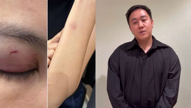 Sau bài xin lỗi của ca sĩ Trung Quân Idol vì hành hung phụ nữ, chồng nạn nhân lên tiếng nói tất cả