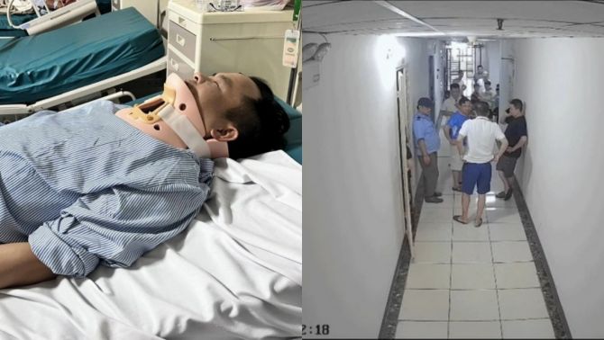 Tình trạng sức khoẻ đáng lo của người bị hành hung khi nhắc cư dân đeo rọ mõm cho chó ở Hà Nội