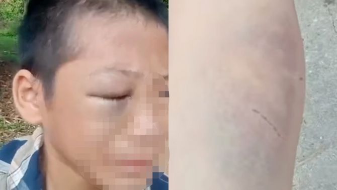 Cơ quan chức năng thông tin vụ bé trai lớp 6 cầu cứu vì bị bố và mẹ kế đánh đập, sợ hãi không dám về nhà
