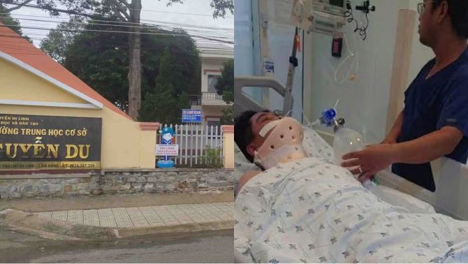 Tin mới vụ nam sinh lớp 8 làm điều tiêu cực nghi do bạo lực học đường, tình hình nạn nhân hiện ra sao?