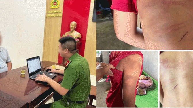 Diễn biến nóng vụ mẹ đau đớn công khai tình trạng ‘đầy ám ảnh’ của con trai nghi bị bố ruột bạo hành