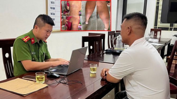 Lời khai của bố đẻ nghi bạo hành con trai 10 tuổi thâm tím người, gia đình tiết lộ hoàn cảnh đáng thương