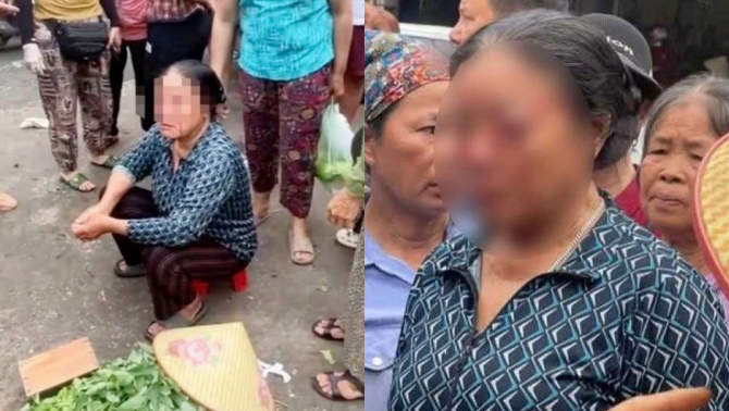 Nhân chứng bức xúc kể lại vụ người phụ nữ bán rau bị xịt nước áp lực cao vào mặt, tình hình nạn nhân?