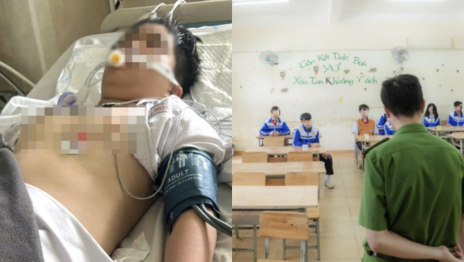 Vụ nam sinh lớp 8 treo cổ vì bị nhóm bạn bắt nạt ở trường: Hé lộ sự việc đau lòng sau khi em tỉnh lại