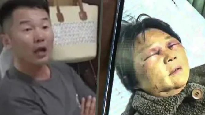 Con dâu đánh mẹ chồng gãy 4 xương sườn vì bà mải yêu quên trông cháu khiến dư luận Trung Quốc phẫn nộ