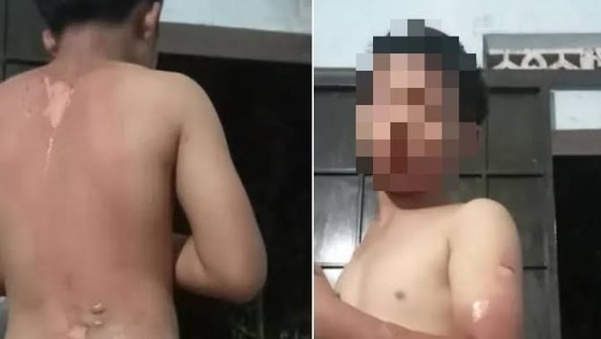 Đắk Lắk: Mẹ ruột thừa nhận tạt nước sôi vào người con, kể lại lý do từ chuyện rất nhỏ nhặt