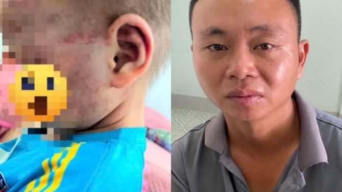 Diễn biến nóng vụ cha dượng tát, bóp cổ con riêng của vợ: Giám đốc Công an Gia Lai chỉ đạo khẩn