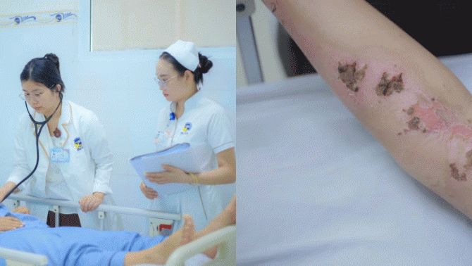 Tình hình hiện tại của cô gái bị sét đánh dẫn đến xuất huyết não? Bác sĩ chỉ cách tránh sét khi trời giông