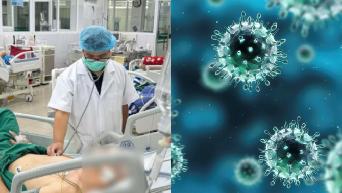 Bác sĩ cảnh báo khẩn về cúm A: Bệnh nhân rơi vào tình trạng nguy kịch dù chỉ sốt khoảng 38 độ C
