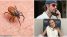 Justin Bieber, Bella Hadid và loạt ngôi sao đình đám mắc bệnh Lyme khó chữa do ve truyền
