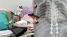 Tìm tài xế xe máy đâm bà lão ở Buôn Ma Thuột rồi bỏ trốn: Nạn nhân gãy 3 đốt sống, chưa có tiền phẫu thuật