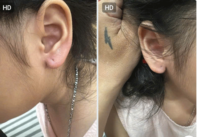 Clip-be-5-tuoi-bi-co-gai-la-mat-cuop-bong-tai-gia-dinh-he-lo-tinh-tiet-thay-ro-do-tao-ton-cua-ke-cuop-1