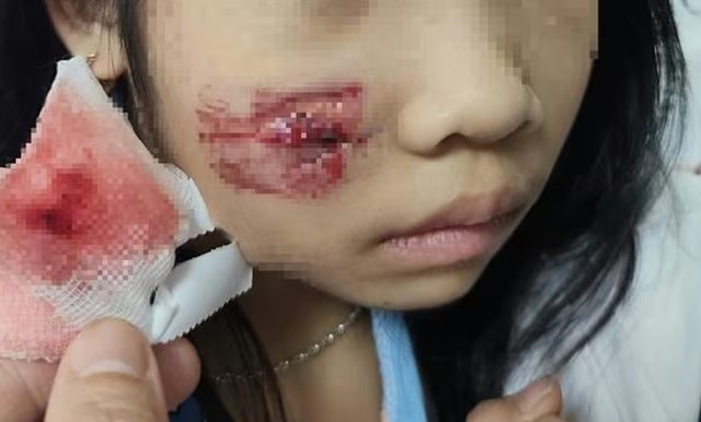 con-khi-hoang-o-quang-binh-tan-cong-5-nguoi-chau-be-7-tuoi-phai-nhap-vien-voi-nhieu-vet-thuong