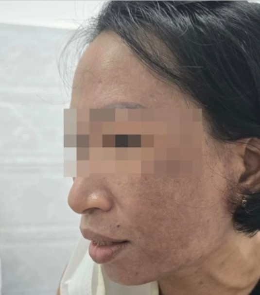 suc-khoe-nguoi-tieu-dung-dang-bi-de-doa-nghiem-trong-khi-dung-my-pham-rom-doi-lot-cao-cap-cua-mailsa-1