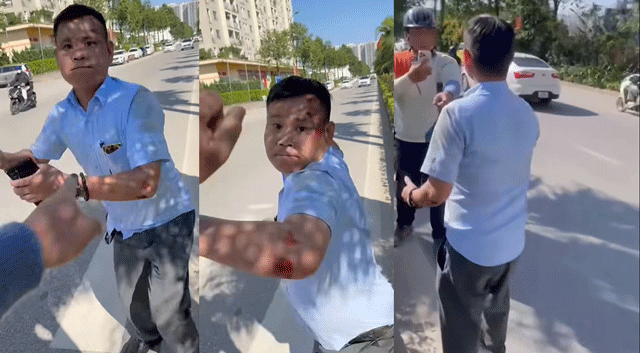 Clip-tai-xe-xe-may-chui-boi-tuc-tiu-dung-mu-bao-hiem-danh-lien-tuc-vao-dau-nam-thanh-nien-gay-buc-xuc-3