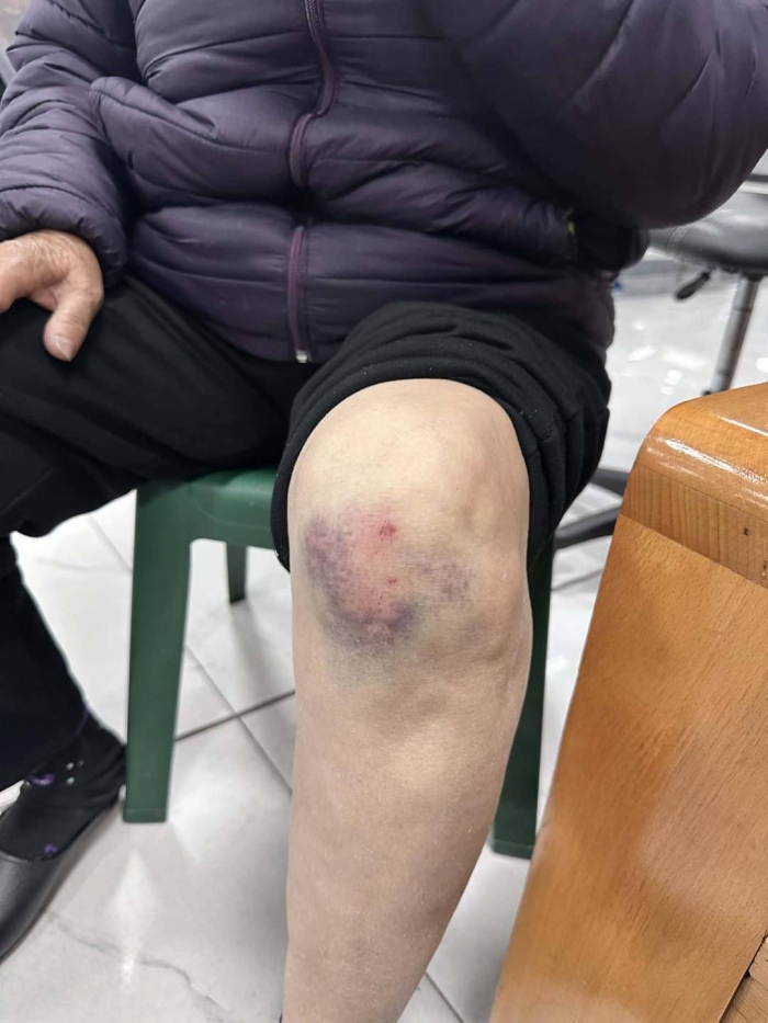 cu-ba-gan-80-tuoi-bi-phu-xe-limousine-ben-xe-bai-chay-hanh-hungh-be-dien-thoai-vi-tu-choi-len-xe-3