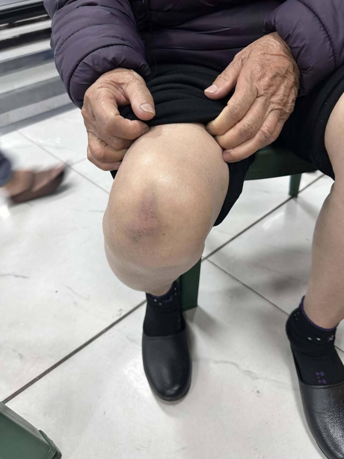 cu-ba-gan-80-tuoi-bi-phu-xe-limousine-ben-xe-bai-chay-hanh-hungh-be-dien-thoai-vi-tu-choi-len-xe-4