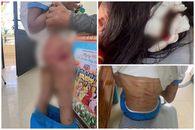 toa-tuyen-an-vu-nguoi-cha-duong-bao-hanh-be-gai-lop-5-o-ha-tinh-voi-vet-thuong-nhieu-khong-the-dem-1