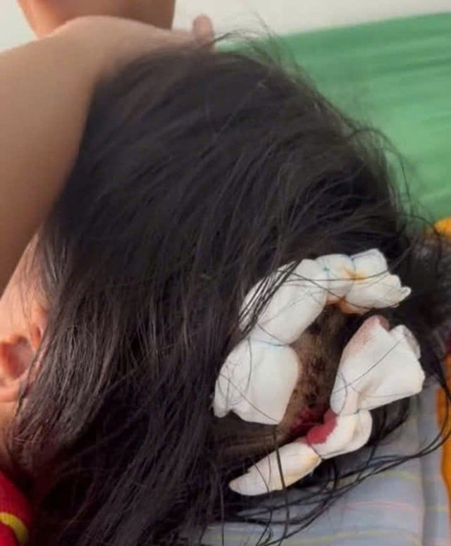 toa-tuyen-an-vu-nguoi-cha-duong-bao-hanh-be-gai-lop-5-o-ha-tinh-voi-vet-thuong-nhieu-khong-the-dem-2