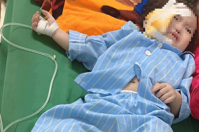 Vu-sap-tran-o-truong-de-trung-3-tre-1-be-bi-thuong-nghiem-trong-ly-do-nha-truong-chua-boi-thuong-4