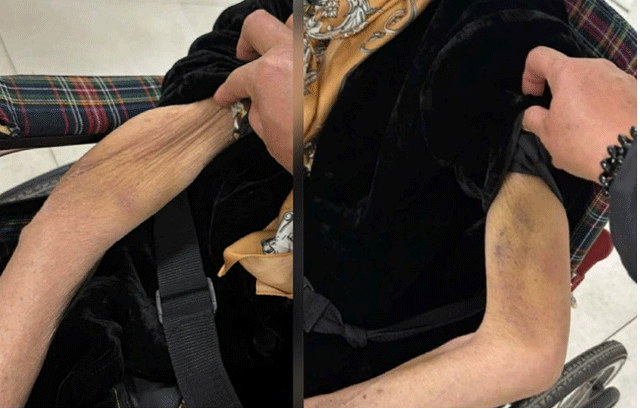 Boc-tran-thu-doan-tinh-vi-ma-nguoi-giup-viec-o-thanh-hoa-dung-de-bao-hanh-cu-ba-82-tuoi-da-man-2