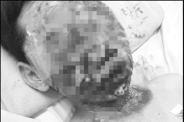 Gia-dinh-xot-xa-khi-mat-con-trai-bi-bien-dang-chan-thuong-nang-sau-khi-dung-phao-mua-qua-mang-2