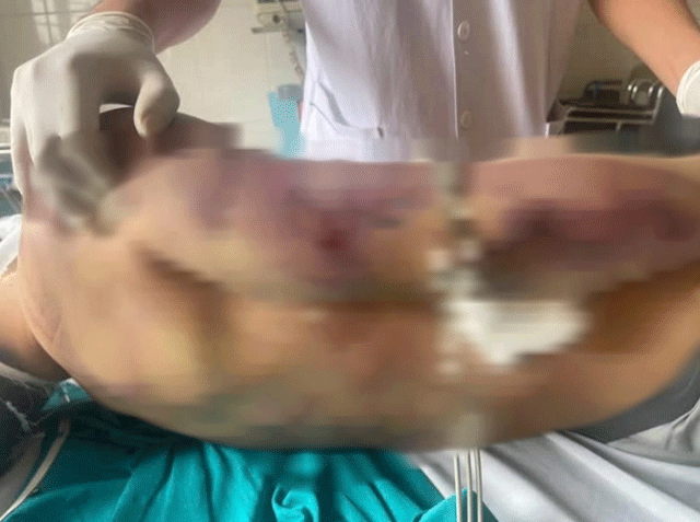 Bo-y-te-ban-hanh-van-ban-hoa-toc-sau-vu-hoc-vien-17-tuoi-tu-vong-sau-2-ngay-hoc-co-so-bao-tro-hai-ha-3