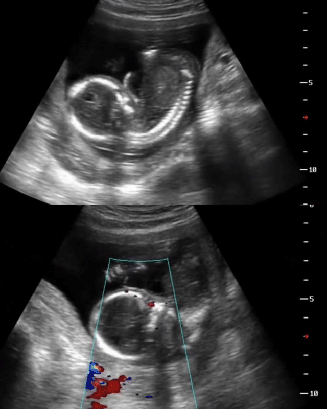 Xot-xa-vu-me-chong-buoc-con-dau-ve-que-lam-co-du-bac-si-canh-bao-can-duong-thai-thai-phu-da-mat-con-3