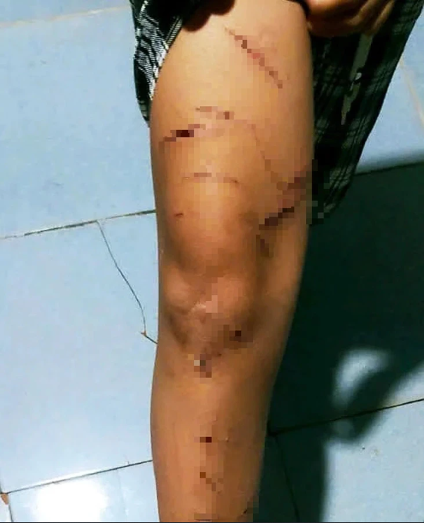 Chu-tich-ubnd-tinh-ca-mau-len-tieng-vu-be-gai-lop-5-bi-chi-ho-dung-dao-cat-giay-rach-nhieu-nhat-1