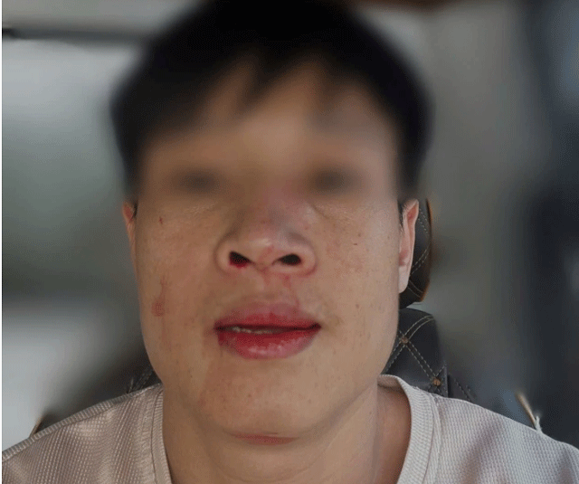 Danh-dap-tai-xe-xe-tai-2