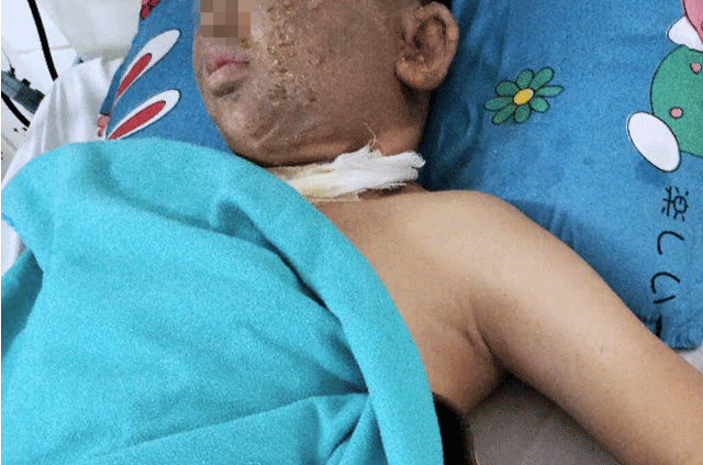 Nam-thanh-nien-mat-mot-mat-2