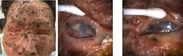 Nam-thanh-nien-mat-mot-mat-3