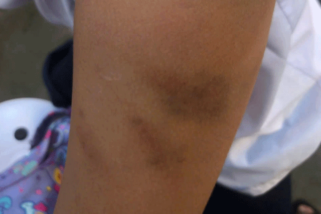 Me-ruot-tac-dong-vat-ly-1