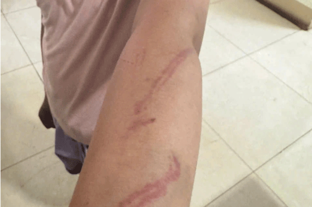 Me-ruot-tac-dong-vat-ly-4